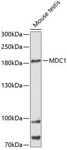 Cell Cycle Antibodies 1 Anti-MDC1 Antibody CAB12714