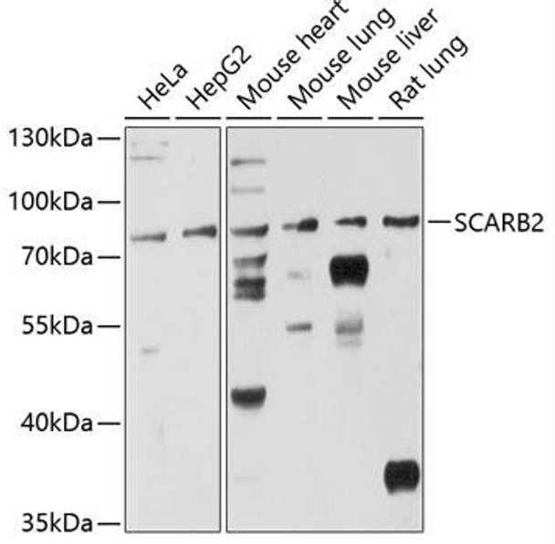 Immunology Antibodies 1 Anti-SCARB2 Antibody CAB12723