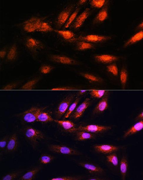 Cell Biology Antibodies 3 Anti-COPS8 Antibody CAB12745