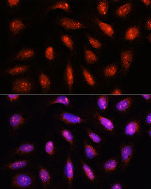 Cell Biology Antibodies 3 Anti-COPS8 Antibody CAB12745