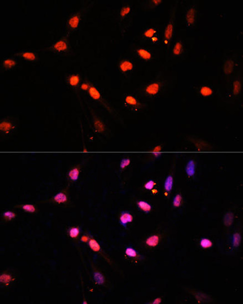 Cell Biology Antibodies 16 Anti-Kdm6b Antibody CAB12763