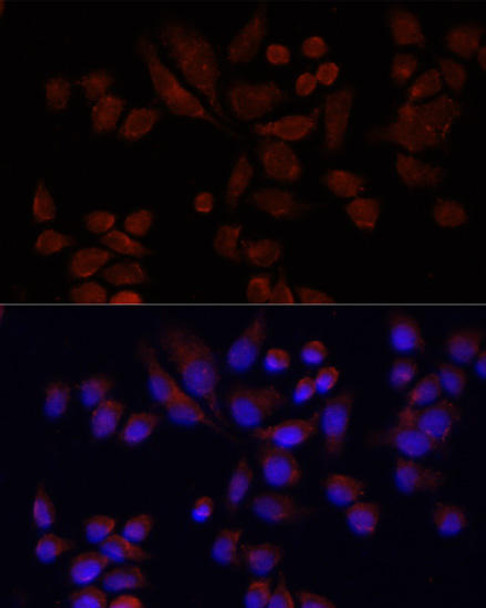 Signal Transduction Antibodies 1 Anti-NAT2 Antibody CAB12766