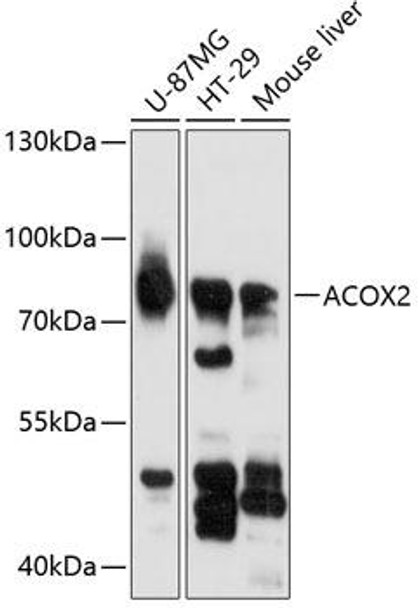 Metabolism Antibodies 1 Anti-ACOX2 Antibody CAB12796