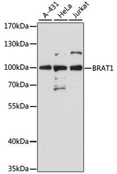 Epigenetics and Nuclear Signaling Antibodies 1 Anti-BRAT1 Antibody CAB12801