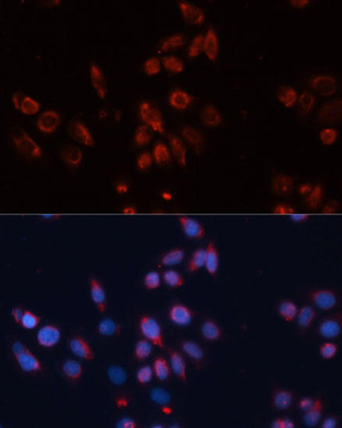 Neuroscience Anti-GPC4 Antibody CAB12805