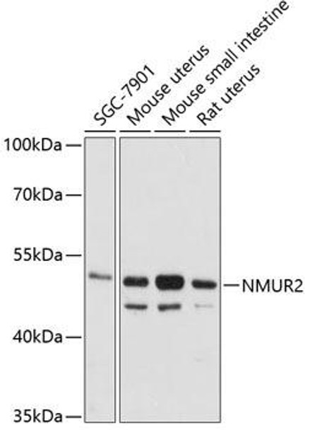 Cell Biology Antibodies 3 Anti-NMUR2 Antibody CAB12812