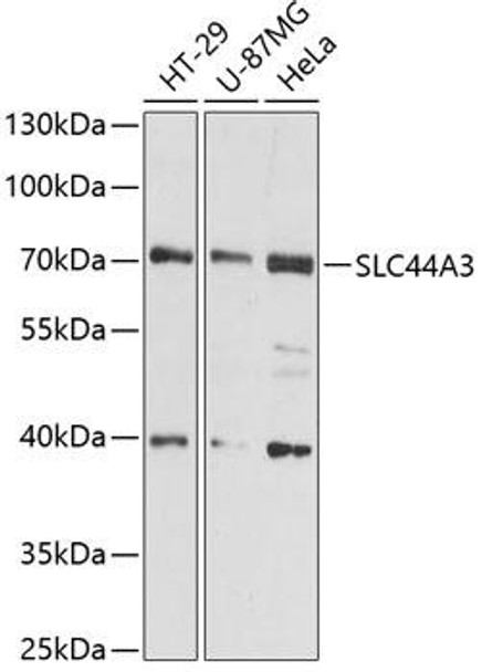 Cell Biology Antibodies 3 Anti-SLC44A3 Antibody CAB12820