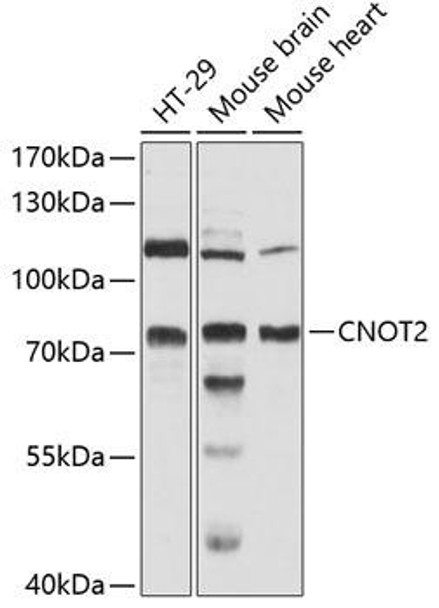 Epigenetics and Nuclear Signaling Antibodies 1 Anti-CNOT2 Antibody CAB12832
