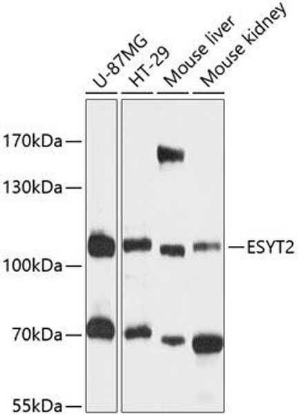 Cell Biology Antibodies 3 Anti-FAM62B Antibody CAB12833