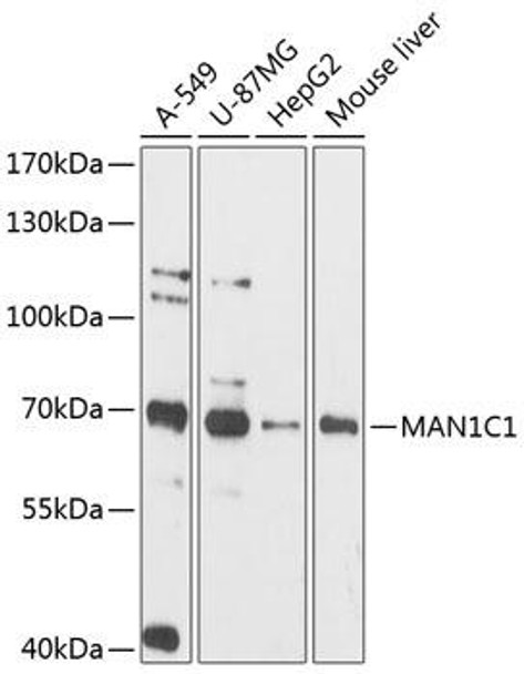 Cell Biology Antibodies 3 Anti-MAN1C1 Antibody CAB12837