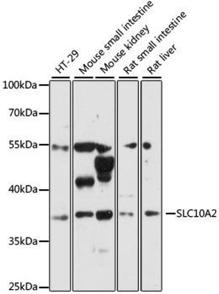 Signal Transduction Antibodies 1 Anti-SLC10A2 Antibody CAB12846