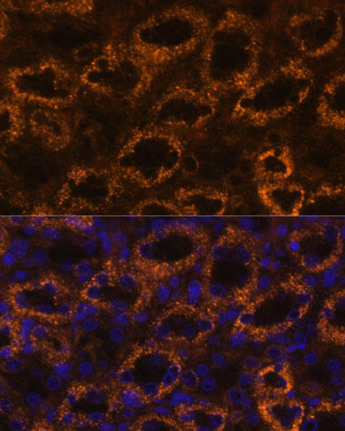 Signal Transduction Antibodies 1 Anti-SLC7A9 Antibody CAB12848