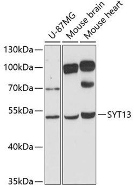 Cell Biology Antibodies 3 Anti-SYT13 Antibody CAB12852