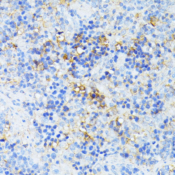 Cell Biology Antibodies 3 Anti-TP53I11 Antibody CAB12855