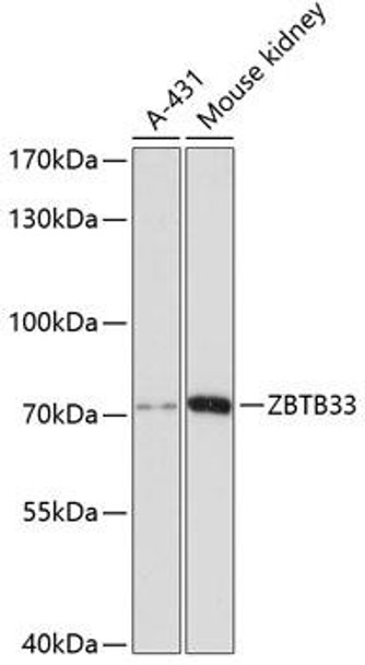 Epigenetics and Nuclear Signaling Antibodies 1 Anti-ZBTB33 Antibody CAB12856