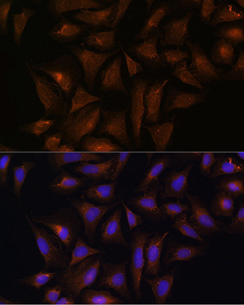 Cell Biology Antibodies 3 Anti-CRYZ Antibody CAB12857