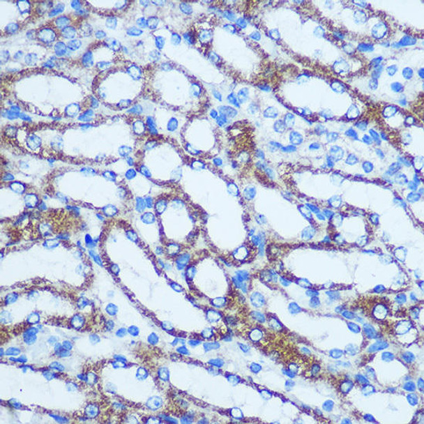 Cell Biology Antibodies 3 Anti-GSTT1 Antibody CAB1287