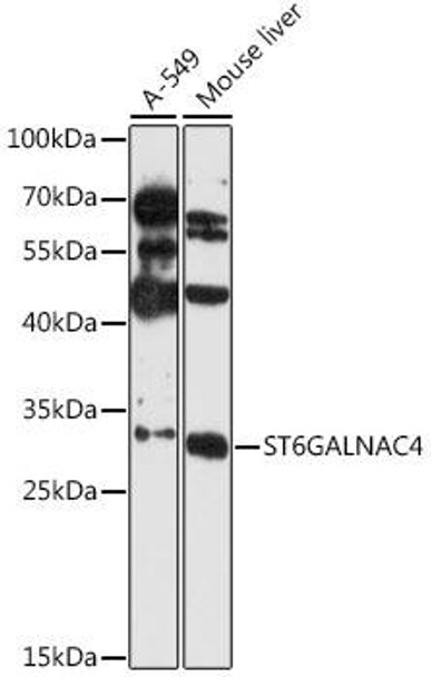 Cell Biology Antibodies 3 Anti-ST6GALNAC4 Antibody CAB12880