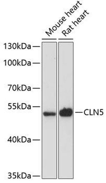 Cell Biology Antibodies 3 Anti-CLN5 Antibody CAB12886