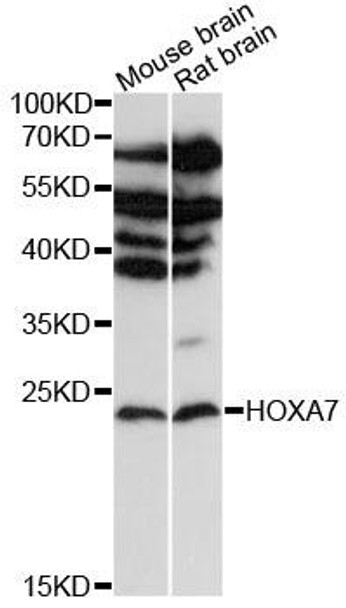 Epigenetics and Nuclear Signaling Antibodies 1 Anti-HOXA7 Antibody CAB12891