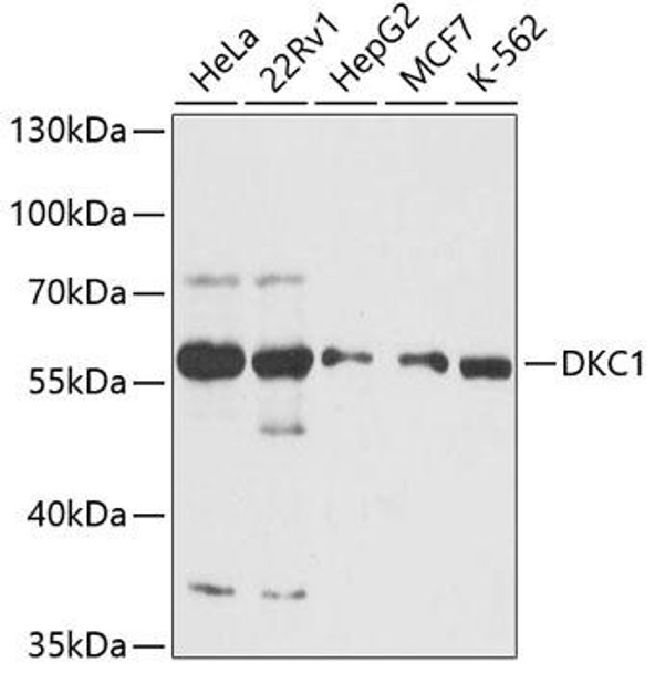 Cell Biology Antibodies 3 Anti-DKC1 Antibody CAB12914