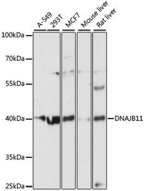 Cell Biology Antibodies 3 Anti-DNAJB11 Antibody CAB12915