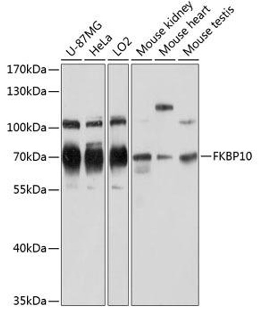 Cell Biology Antibodies 3 Anti-FKBP10 Antibody CAB12931