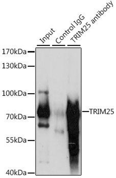 Immunology Antibodies 1 Anti-TRIM25 Antibody CAB12938