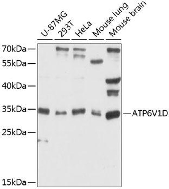 Cell Biology Antibodies 3 Anti-ATP6V1D Antibody CAB12940