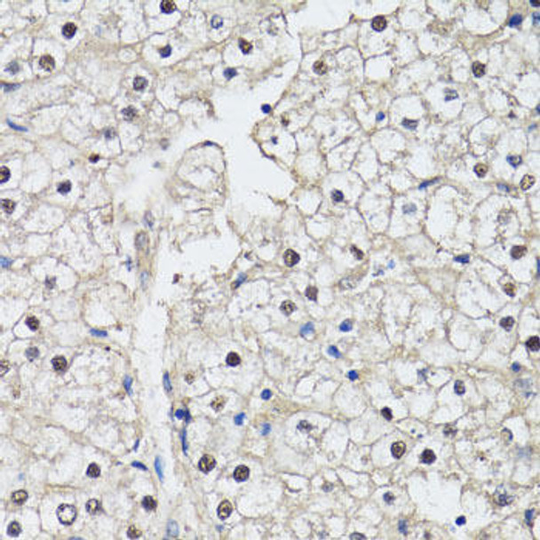 Cell Cycle Antibodies 1 Anti-CDK7 Antibody CAB12942