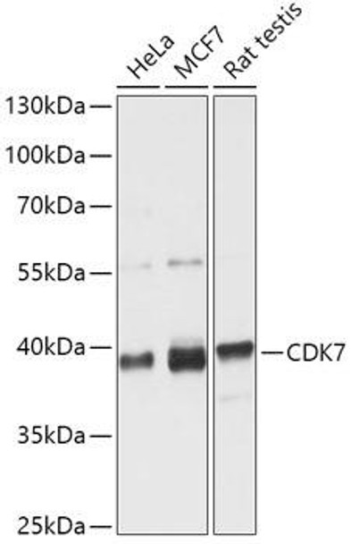 Cell Cycle Antibodies 1 Anti-CDK7 Antibody CAB12942