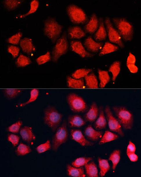 Cell Cycle Antibodies 1 Anti-CDK7 Antibody CAB12942