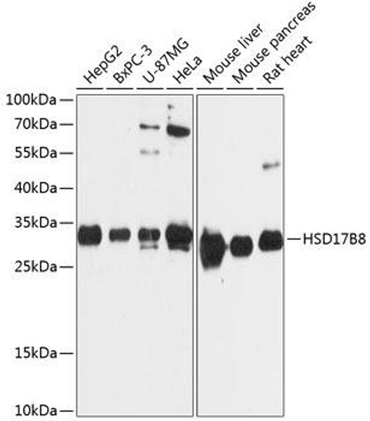 Metabolism Antibodies 1 Anti-HSD17B8 Antibody CAB12947