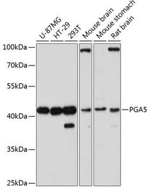Cell Biology Antibodies 3 Anti-PGA5 Antibody CAB12951