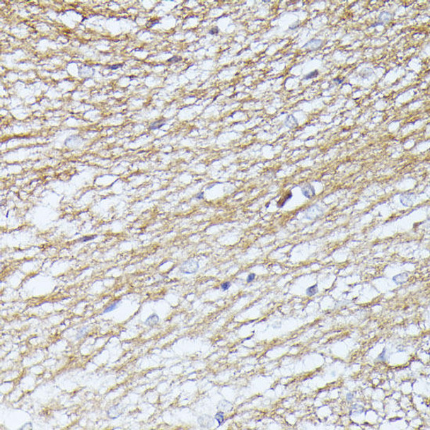 Cell Cycle Antibodies 1 Anti-SEPT5 Antibody CAB12953