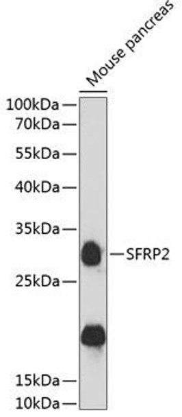 Developmental Biology Anti-SFRP2 Antibody CAB12959