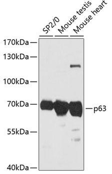 Cell Death Antibodies 1 Anti-p63 Antibody CAB12960