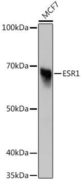 Epigenetics and Nuclear Signaling Antibodies 1 Anti-ESR1 Antibody CAB12976