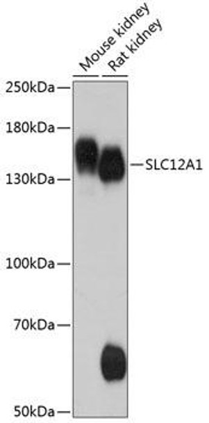 Signal Transduction Antibodies 1 Anti-SLC12A1 Antibody CAB12999