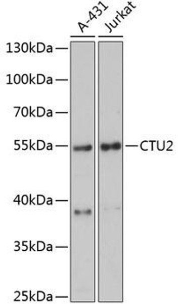 Epigenetics and Nuclear Signaling Antibodies 1 Anti-CTU2 Antibody CAB13003