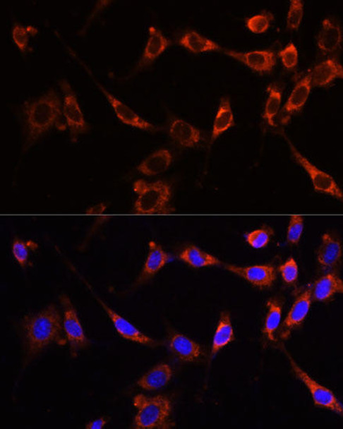 Cell Biology Antibodies 3 Anti-PTPN13 Antibody CAB13005