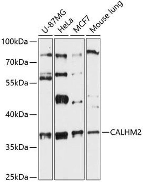 Signal Transduction Antibodies 1 Anti-CALHM2 Antibody CAB13006