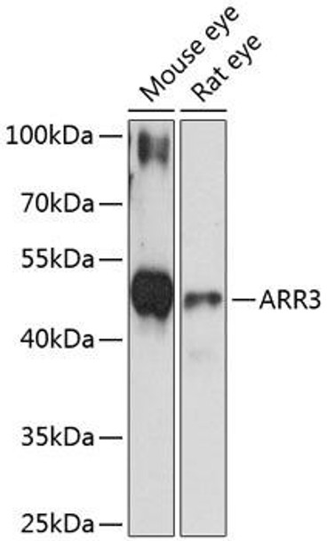 Signal Transduction Antibodies 1 Anti-ARR3 Antibody CAB13009