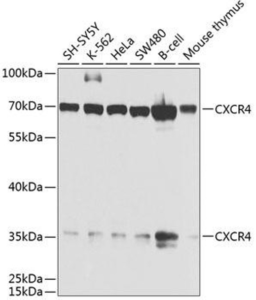 Immunology Antibodies 1 Anti-CXCR4 Antibody CAB1303