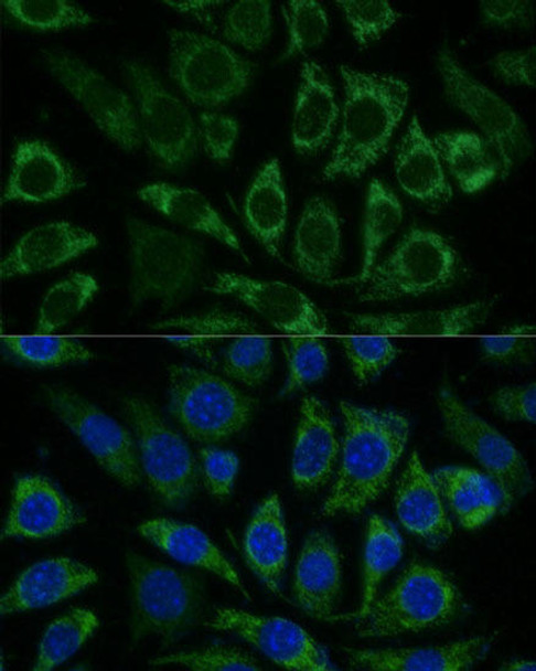 Cell Biology Antibodies 3 Anti-NDUFS8 Antibody CAB13034