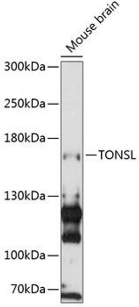 Epigenetics and Nuclear Signaling Antibodies 1 Anti-TONSL Antibody CAB13035