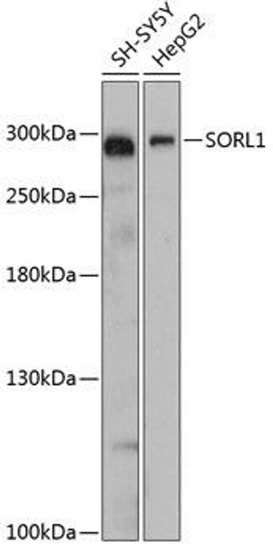 Cell Biology Antibodies 3 Anti-SORL1 Antibody CAB13047