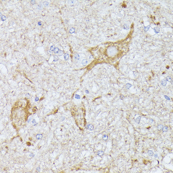 Cell Biology Antibodies 3 Anti-TBCA Antibody CAB13050