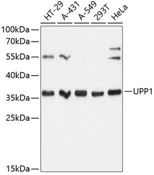 Cell Biology Antibodies 3 Anti-UPP1 Antibody CAB13051
