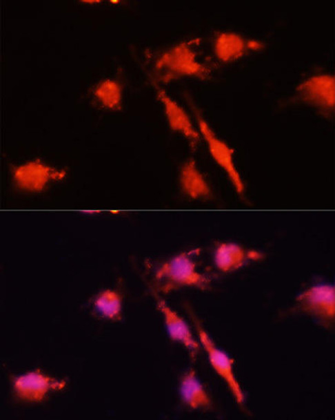 Cell Biology Antibodies 3 Anti-BDNF Antibody CAB1307